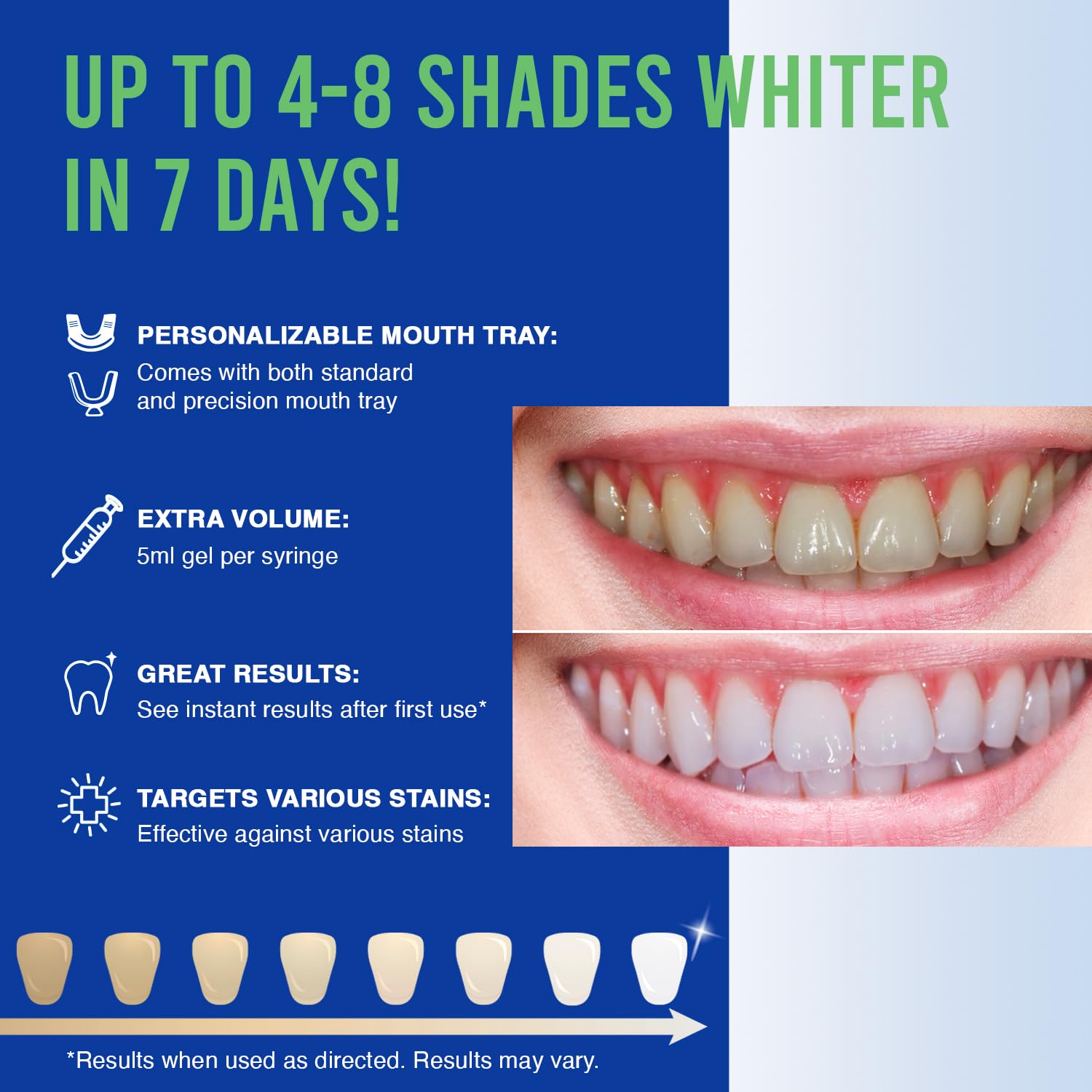 VieBeauti Teeth Whitening Kit - 5X LED Light Tooth Whitener with 35% Carbamide Peroxide, Mouth Trays, Remineralizing Gel and Tray Case - Built-in 10 Minute Timer Restores Your White Smile Mint