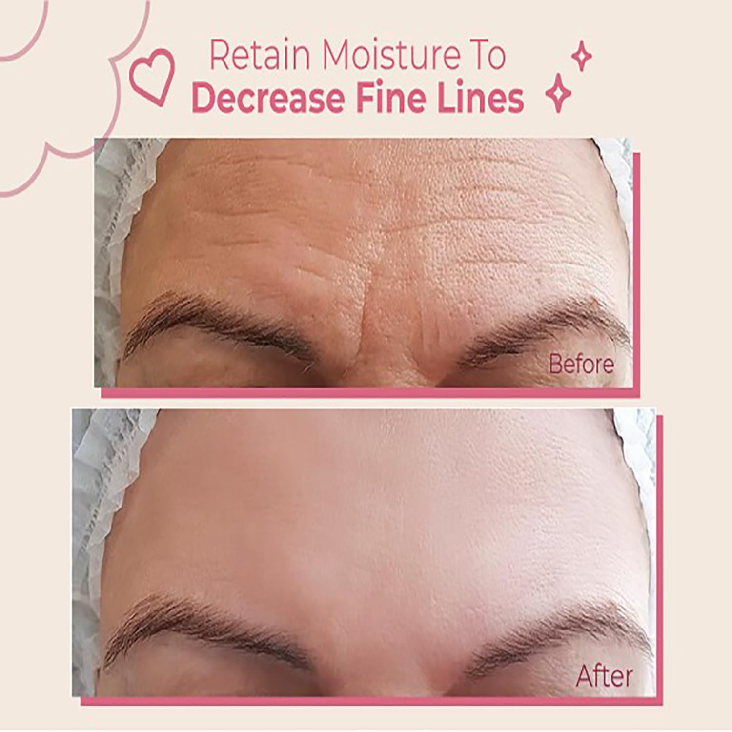 Forehead Wrinkle Patches Reusable | Forehead Wrinkles Treatment | Patches For Wrinkles | Non Invasive Reusable Wrinkle Smoothers | Works Great with an Eye Wrinkle Patches Kit and Face Tape | 2 Patches