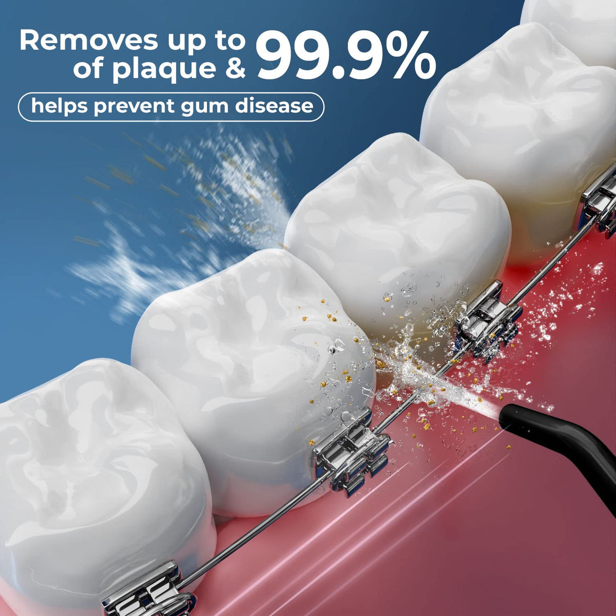Water flosser for Teeth Cleaning and flossing Oral irrigator, Black