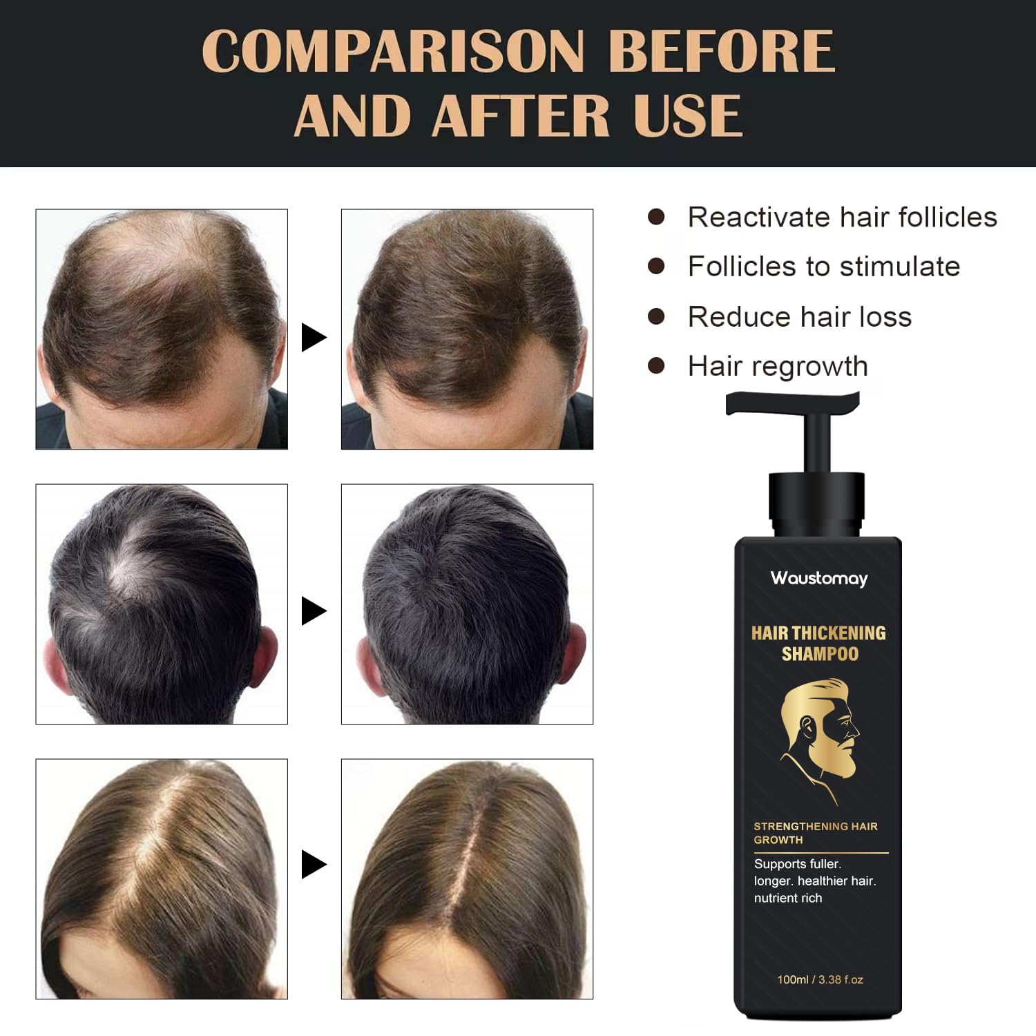 Root Activator Shampoo-Hair thickening shampoo-Suitable for men and women with hair loss and thinning hair-Natural formula makes hair smooth-100ml