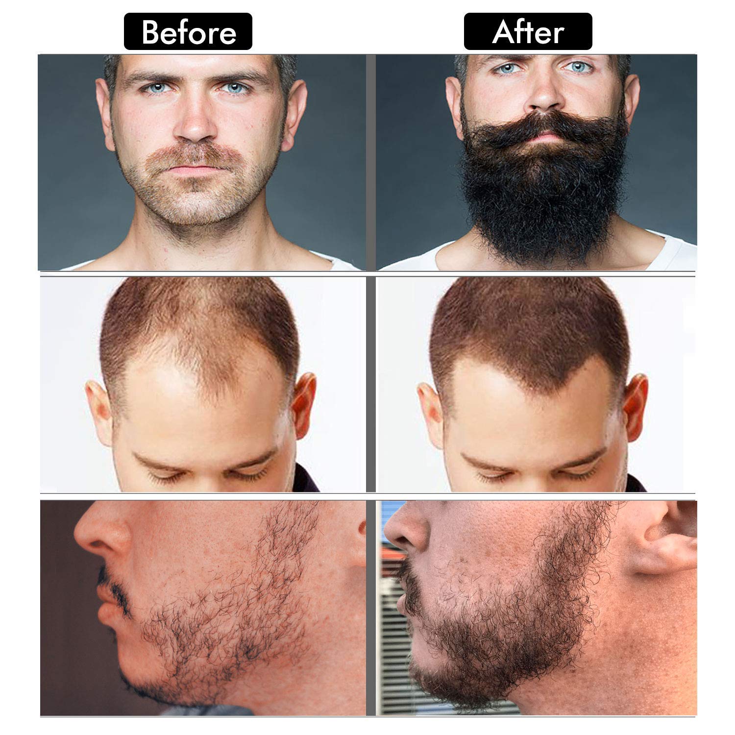 Beard Growth Kit - Beard Kit for Men, Beard Growth Oil (2oz), Beard Balm, Beard Comb, Massager for Spot/Patchy Beard - Christmas, Anniversary, Birthday Gifts for Men, Dad, Husband, Boyfriend