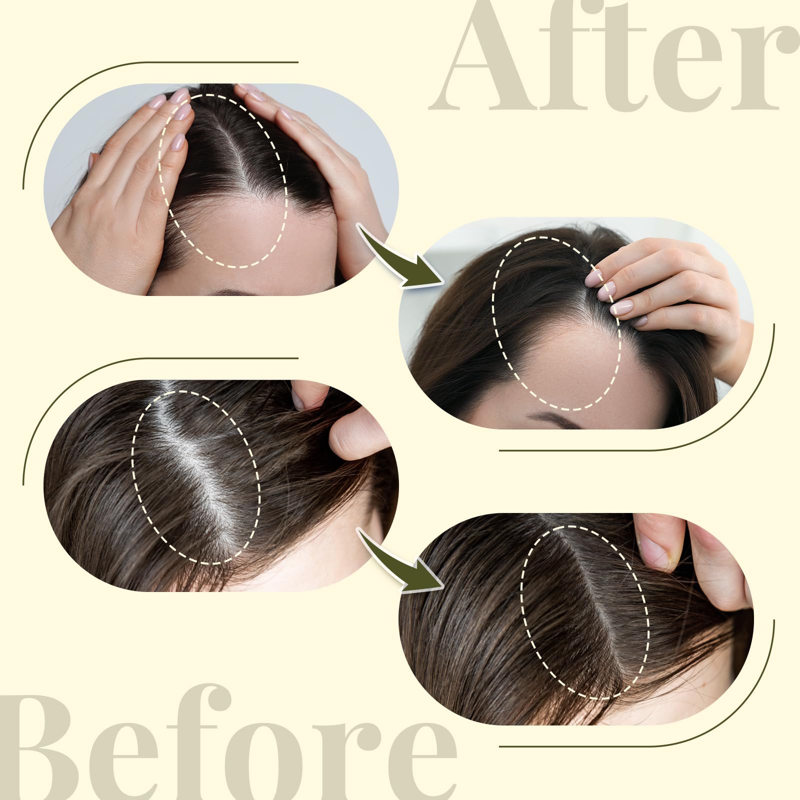 RootStim Raw Batana Oil for Hair Growth - 100% Pure & Natural Hair Growth Oil - Sourced from Honduras by Dr. Sebi Batana Oil for Hair Growth and Thickness for Women and Men