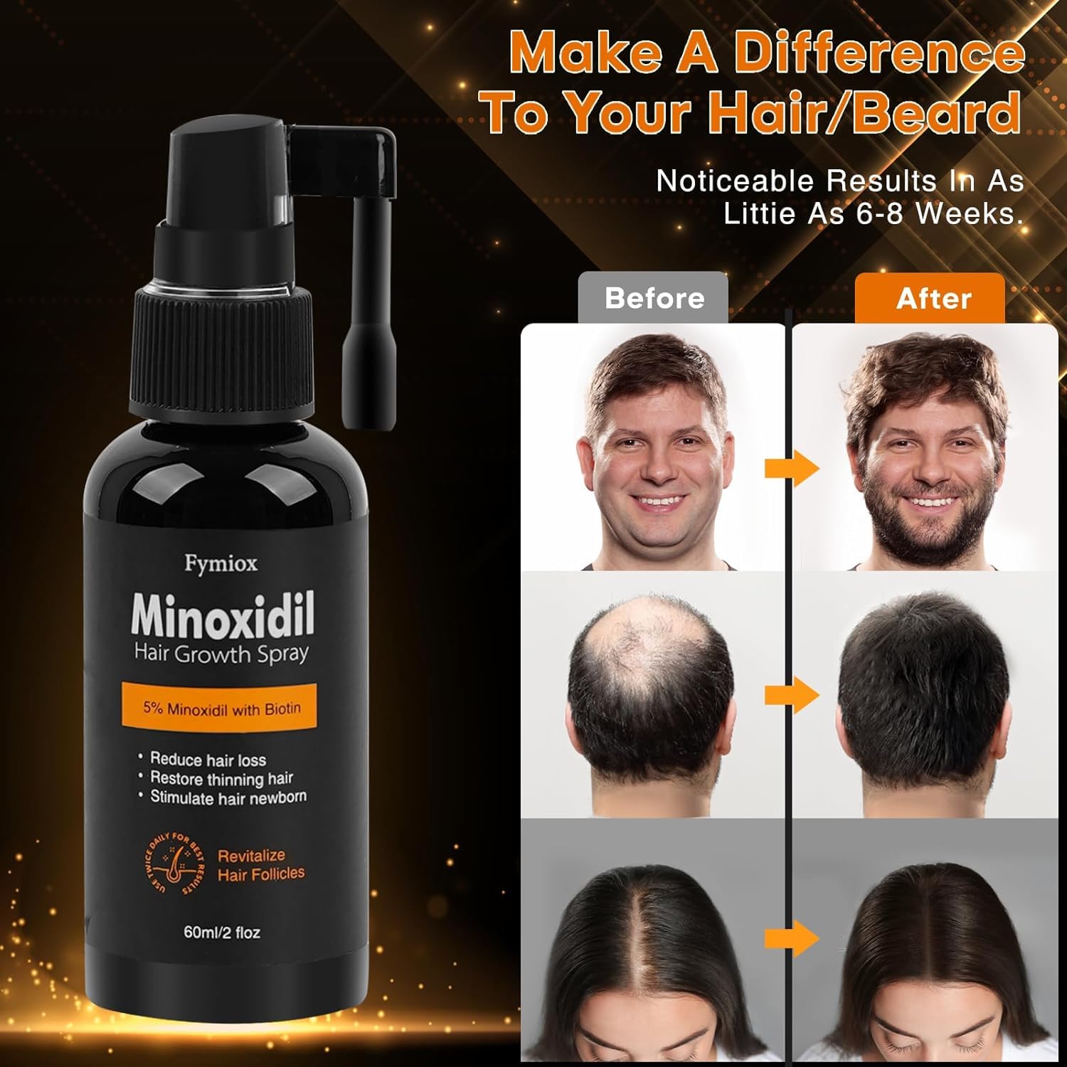 Minoxidil for Men and Women Hair Growth, 5% Minoxidil for Men Beard Growth,Hair Regrowth Treatment for Thinning Hair and Hair Loss (Fl Oz, 2)