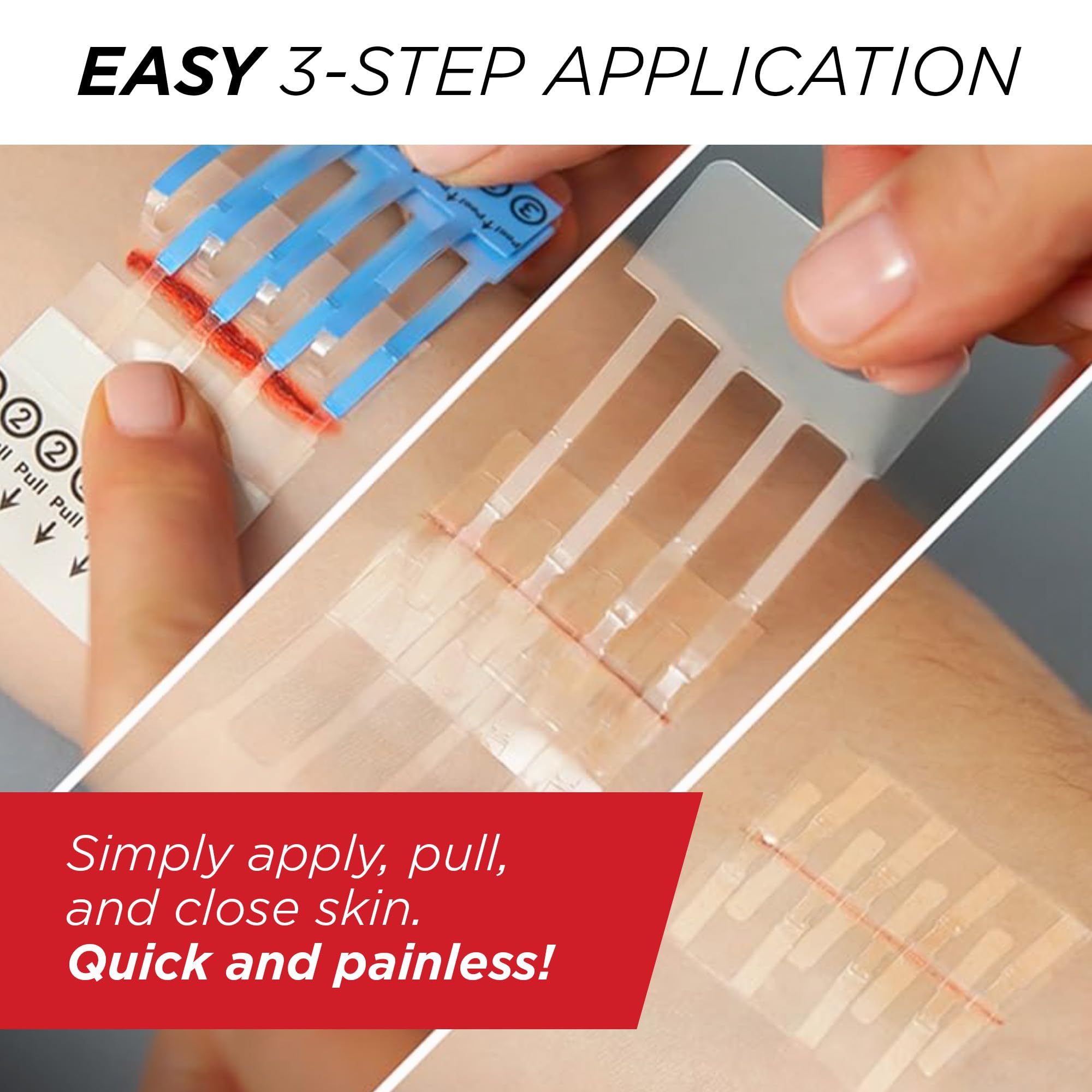 Clozex Wound Closure Device - Repair 3 Individual 3 3/8" Lacerations Without Stitches, FDA Cleared