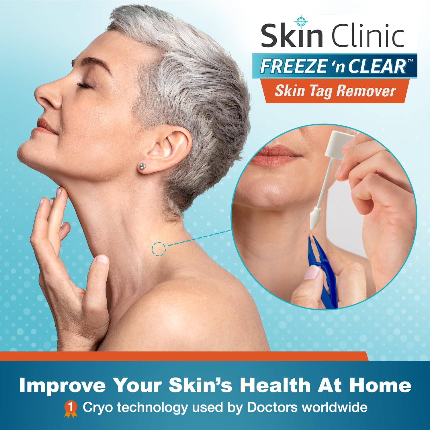 Skin Clinic FREEZE 'n CLEAR SkinTAG Remover (FDA-Cleared) at Home Cryo Kit (As Little As 1 Treatment) 8 Applicators + Tweezers