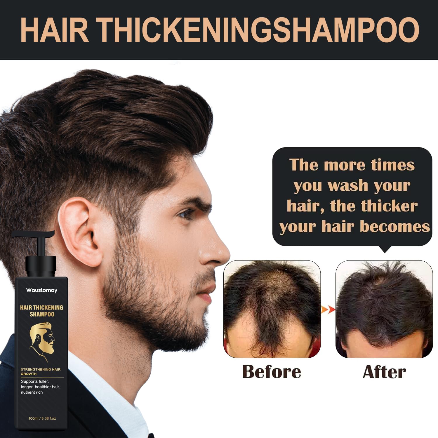 Root Activator Shampoo-Hair thickening shampoo-Suitable for men and women with hair loss and thinning hair-Natural formula makes hair smooth-100ml