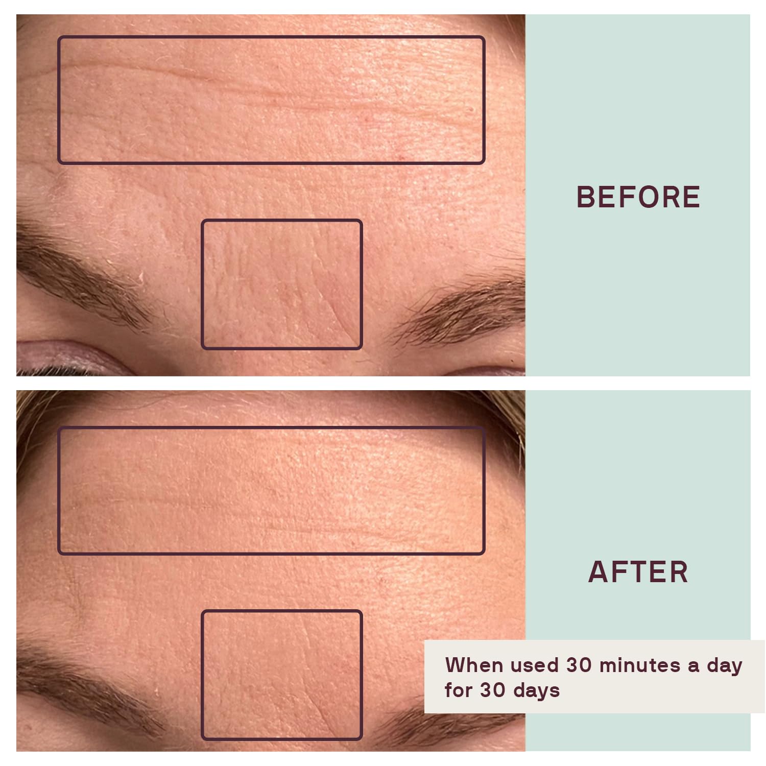 Dermaclara Silicone Face Patches for Wrinkles & Fine Lines - Anti-Wrinkle, Facial Silicone Forehead and Under Eye Patches - Pregnancy Safe Skincare - Silicone Face Patches Reusable up to 30 Times