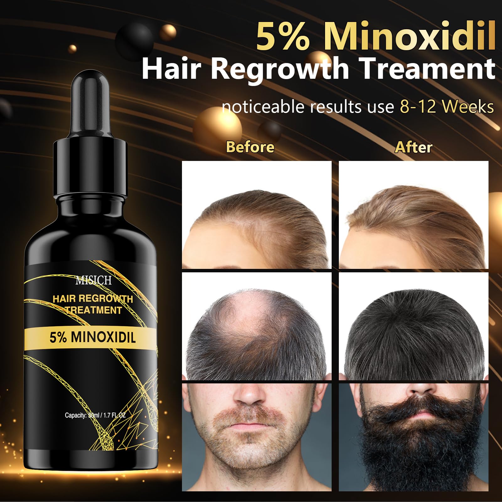 MGLIMZ 5% Minoxidil for Men Women Hair Growth, Hair Growth minoxidil for men beard Regrowth Treatments, Extra Strength Minoxidil Hair Oil for Thicker Longer Fuller Healthier Hair
