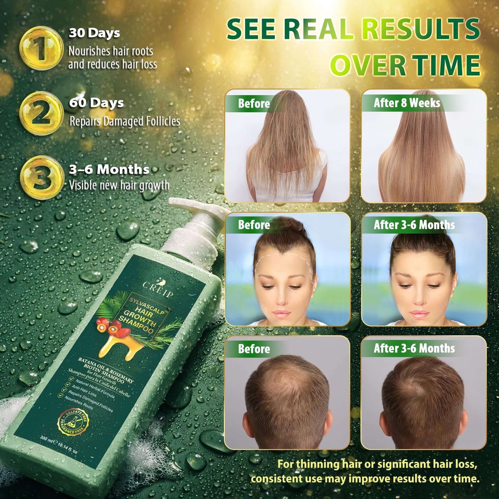Rosemary & Batana Oil Hair Growth Shampoo: Hair Loss Shampoo for Men and Women with Biotin, Sulfate & Fragrance-Free Thickening