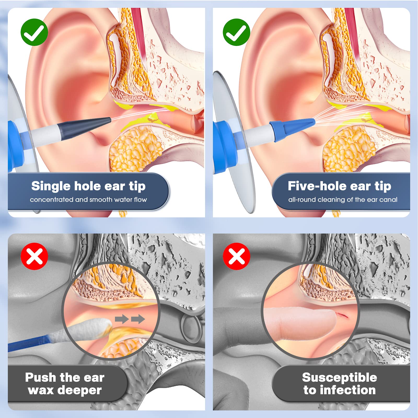 Ear Wax Removal, Electric Ear Cleaning Kit with Light, FSA HSA Eligible, Ear Irrigation Kit with 4 Pressure Modes, Safe and Effective Ear Flush Kit with Ear Cleaner - Includes Basin, Towel & 15 Tips