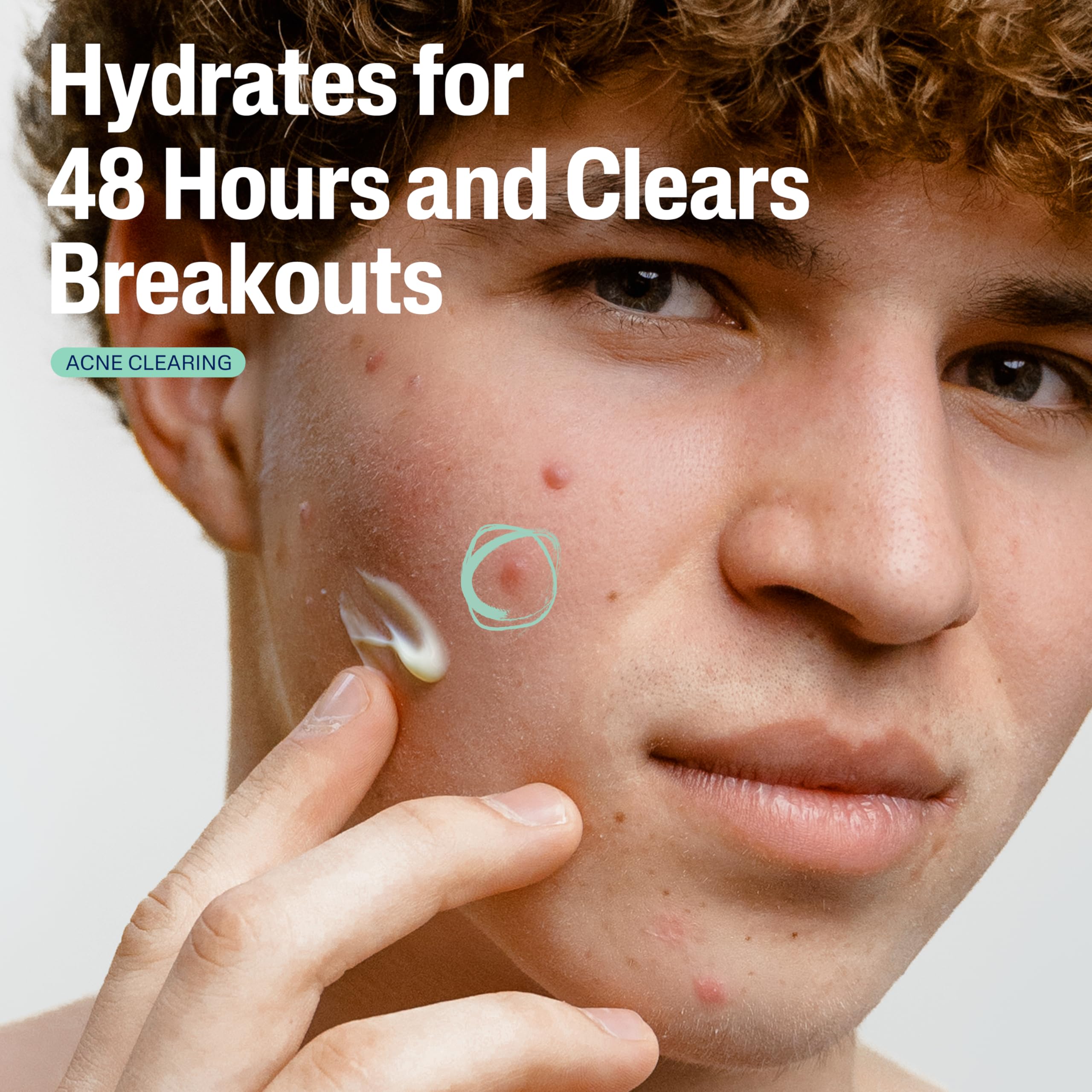 Cetaphil Face Moisturizer, Gentle Clear Mattifying Acne Moisturizer With 0.5% Salicylic Acid, Hydrates and Treats Sensitive Acne Prone Skin, Skin Care for Sensitive Skin, 3oz