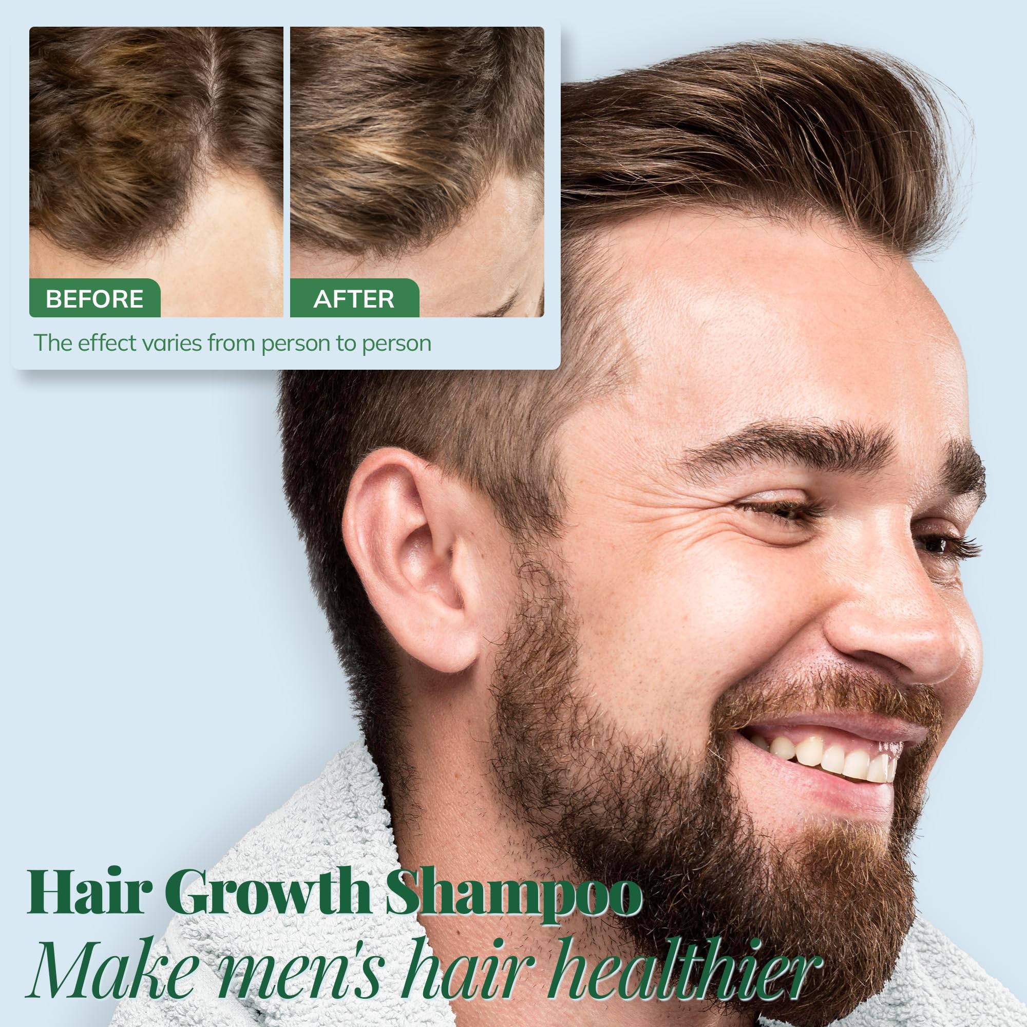 Hair Growth Shampoo with Rosemary and Biotin - Hair Thickening & Hair Loss Shampoo for Men and Women, Sulfate & Paraben-Free Scalp Care for All Hair Types(12.8 Fl Oz)