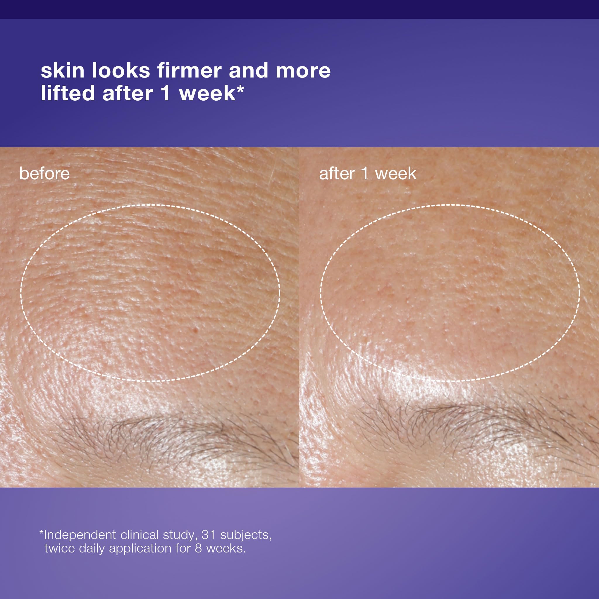 Dermalogica Phyto Nature Oxygen Cream, Daily Liquid Moisturizer for Face - Firms, Lifts and Revitalizes with Hydrating Oxygen-Optimizing Phytoactives, 1.7 fl oz