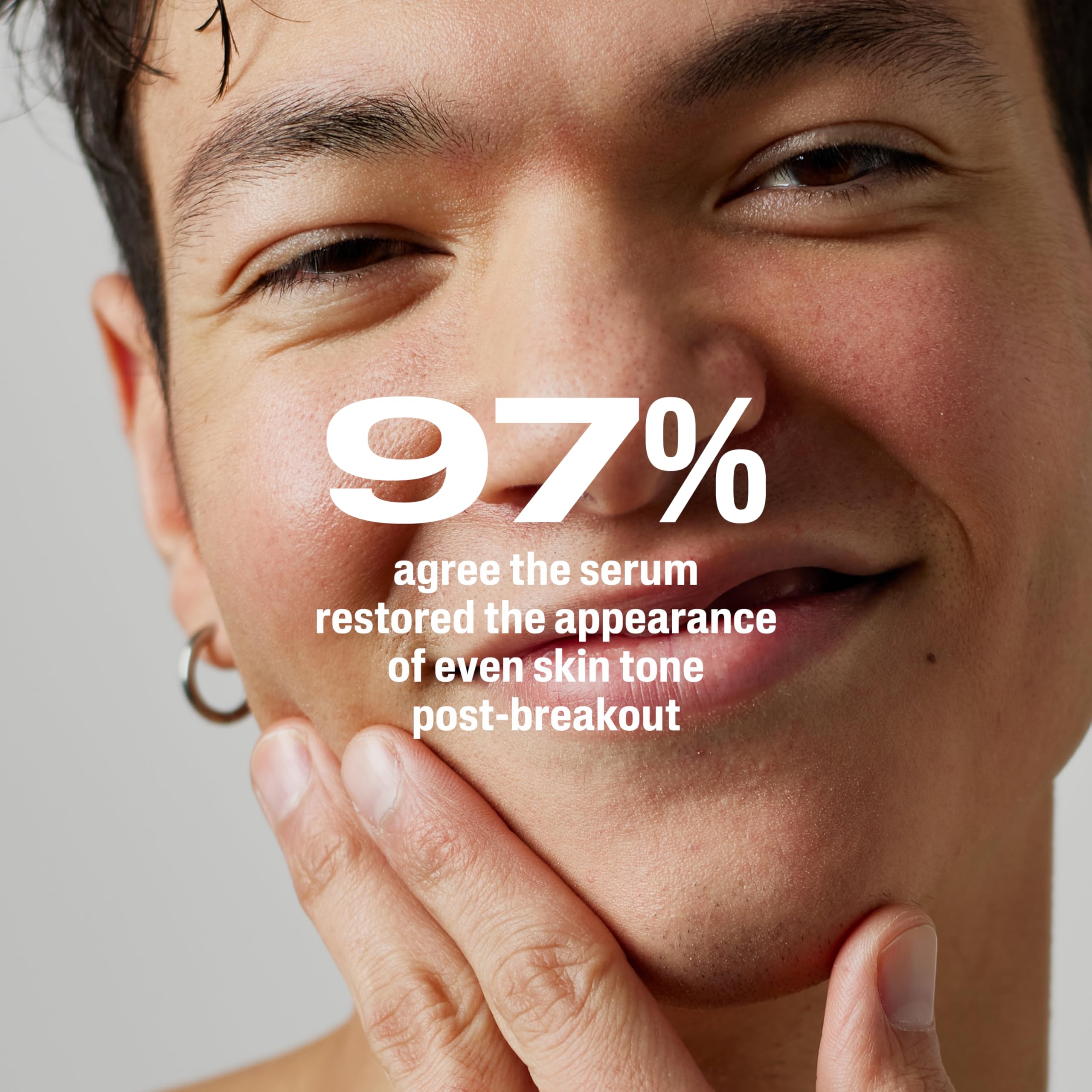 CETAPHIL Gentle Clear Repairing Post-Acne Serum, Retinol Alternative, Oil Free Serum for Sensitive Skin, 1 Fl Oz, Bakuchiol, Improves Skin Tone & Post-acne Marks, Dermatologist Recommended Brand