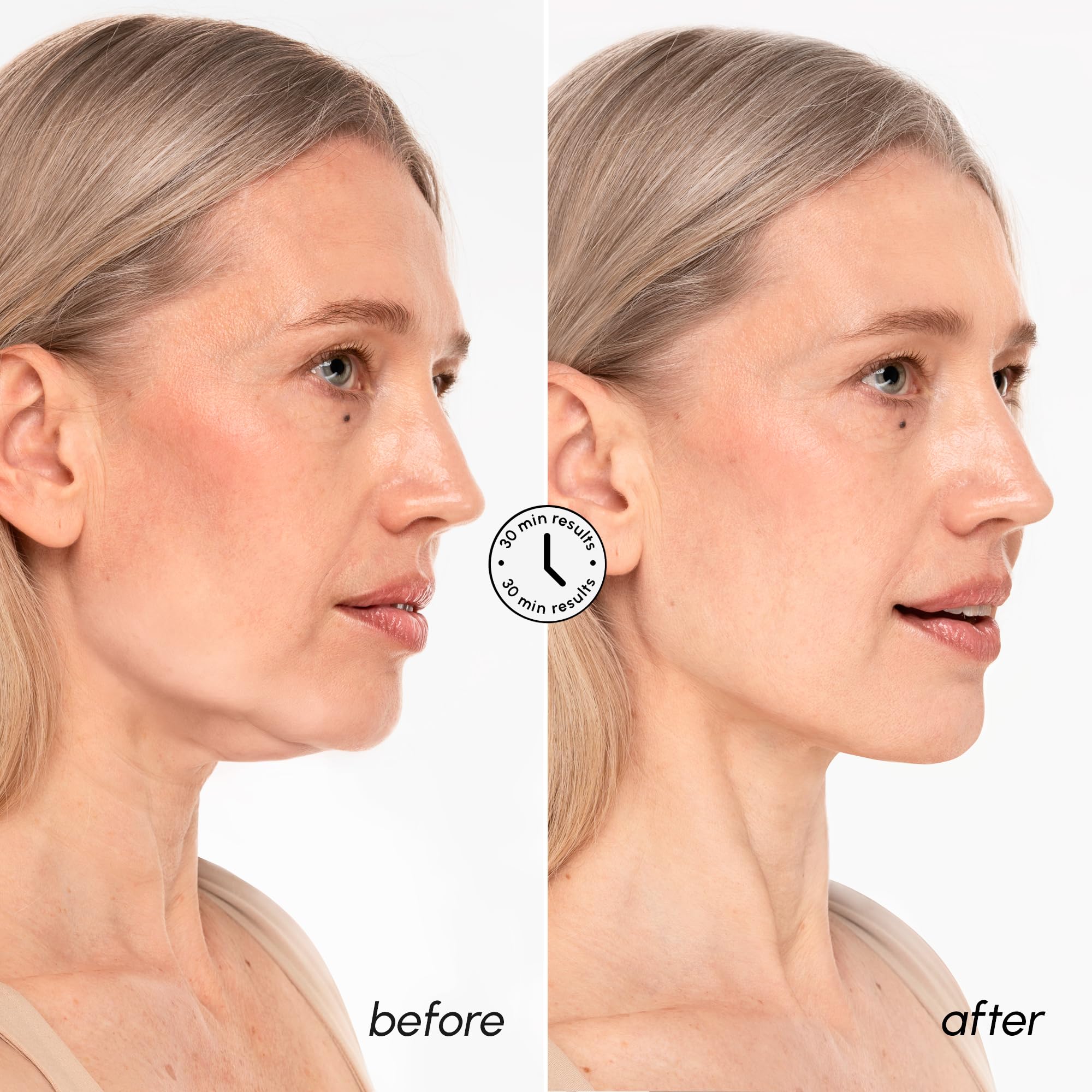 MAREE V Line Lifting Mask with 24K Gold – Deep Collagen Face Mask for Women – Jawline Shaper Mask with Retinol & Hyaluronic Acid – Neck Tightening & Firming - Double Chin Strap for Face Lift