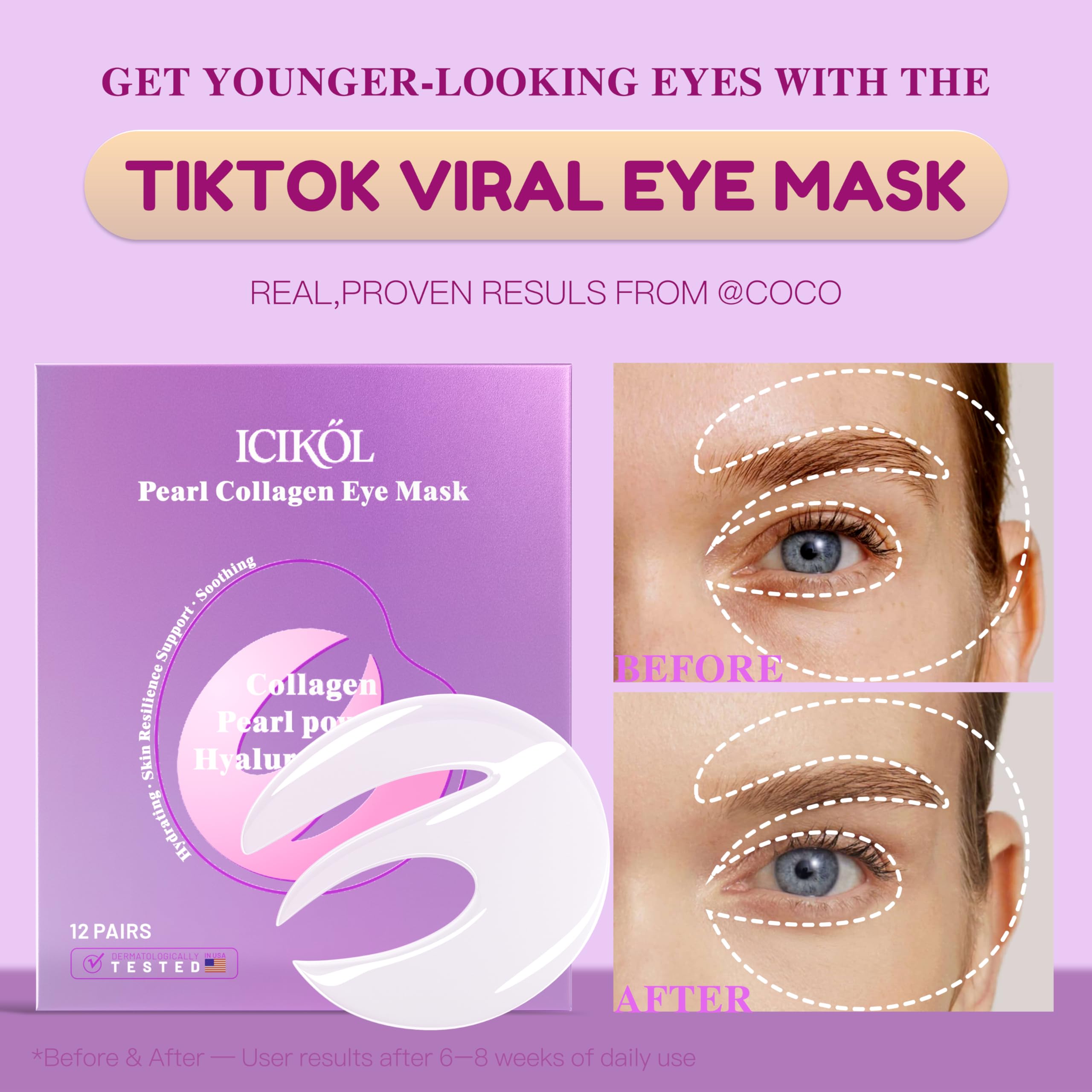 ICIKOL Under Eye Patches with Collagen, Eye Patches for Puffy Eyes and Dark Circles, 360° Under Eye Mask for Puffiness, Wrinkles, Fine Lines, Gifts for Women - Skin Care, 12 Pairs (White)