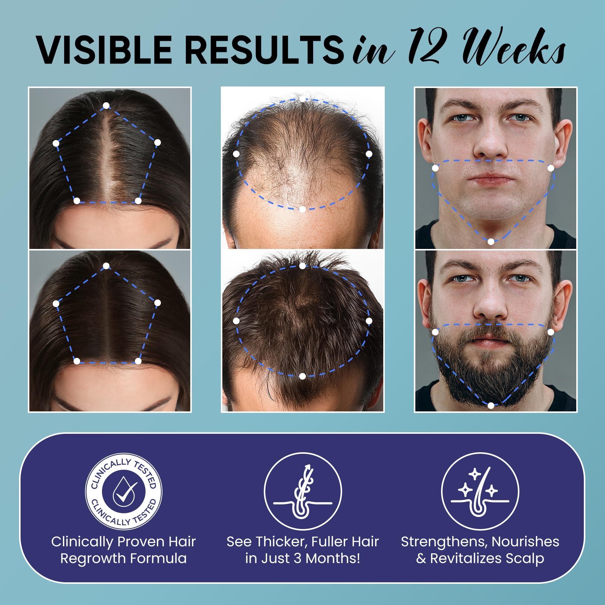 5% Minoxidil for Men and Women Hair Growth: Minoxidil Spray Hair Regrowth Treatment Serum with Biotin & Rosemary -Stop Hair Thinning and Hair Loss For Stronger Thicker Longer Hair 2 Pack