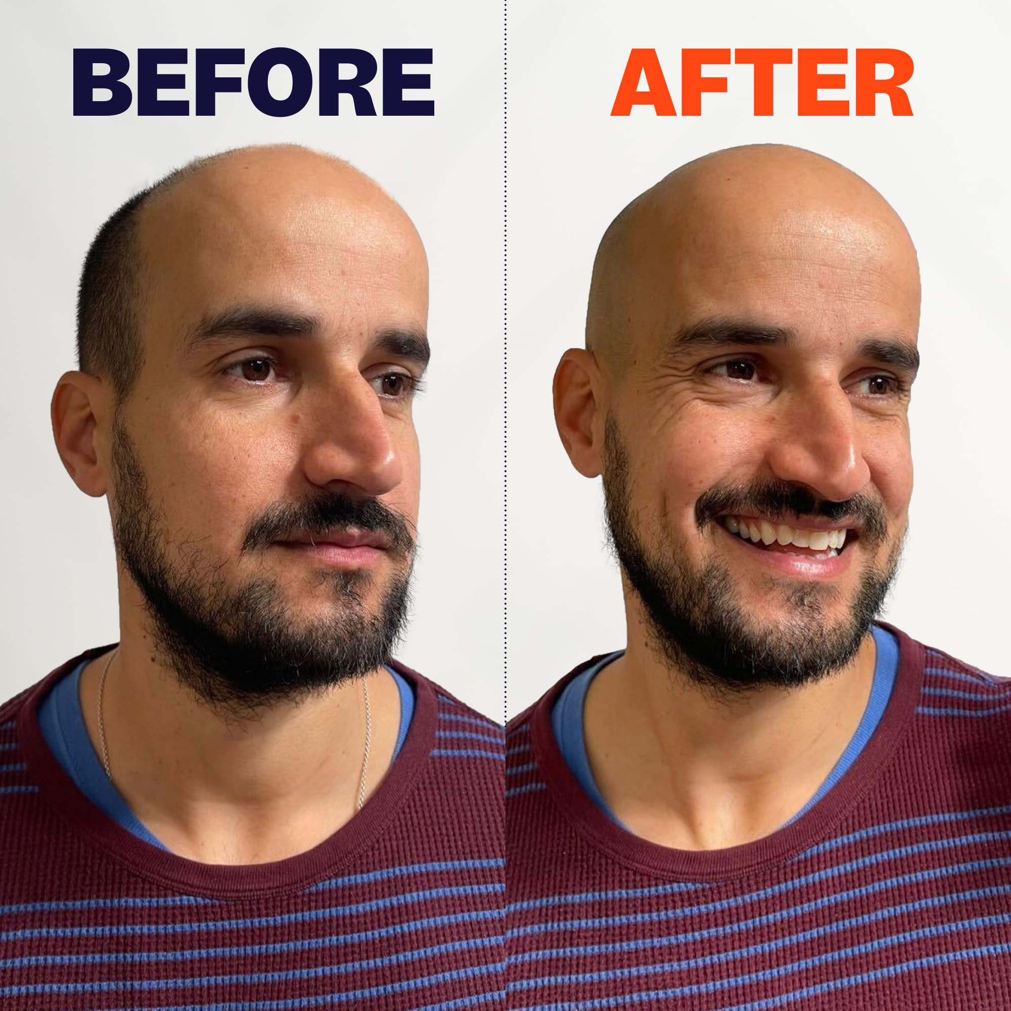 The FlexSeries Electric Head Hair Shaver - Freebird - Ultimate Mens Cordless Rechargeable Wet/Dry Skull & Bald Head Waterproof Razor with Rotary Blades, Clippers, Nose Trimmer, Brush, Massager