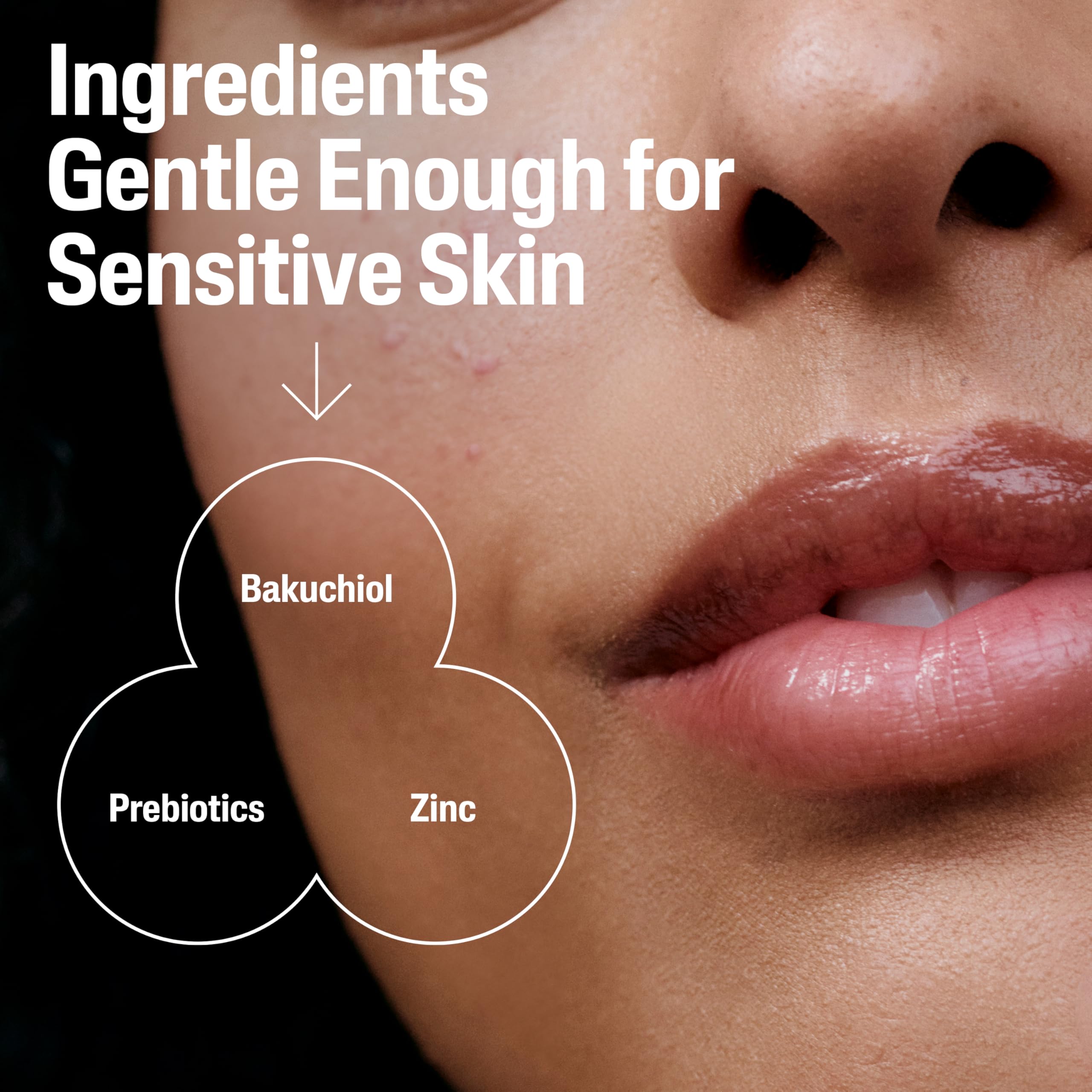 CETAPHIL Gentle Clear Repairing Post-Acne Serum, Retinol Alternative, Oil Free Serum for Sensitive Skin, 1 Fl Oz, Bakuchiol, Improves Skin Tone & Post-acne Marks, Dermatologist Recommended Brand