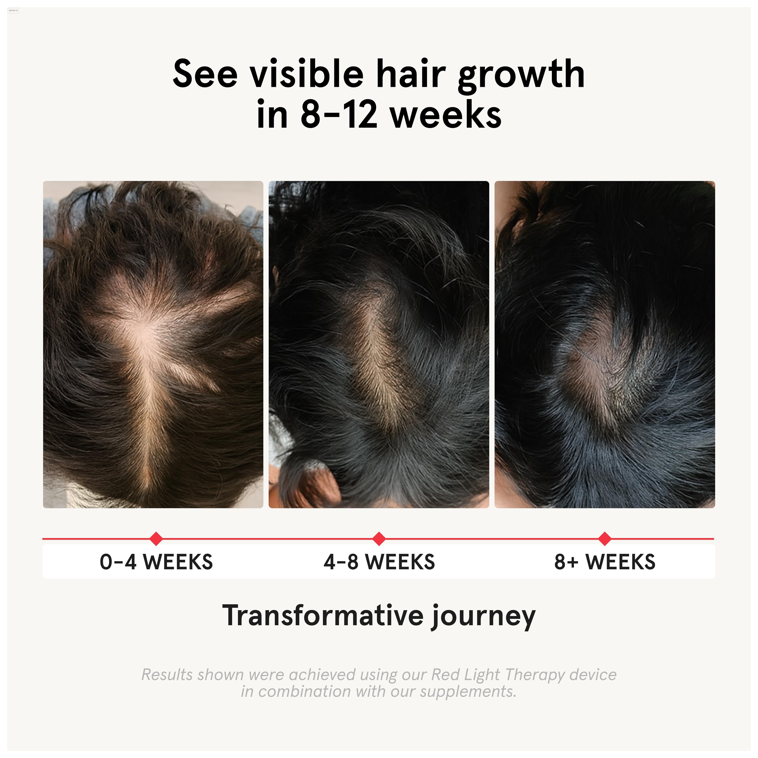 iRestore Hair Growth Supplement - Hair Loss Vitamins for Women and Men - Biotin Multivitamins & DHT Blocker to Reduce Hair Thinning - Hair Regrowth Pills - 30 Days Supply 90 Count (Pack of 1)