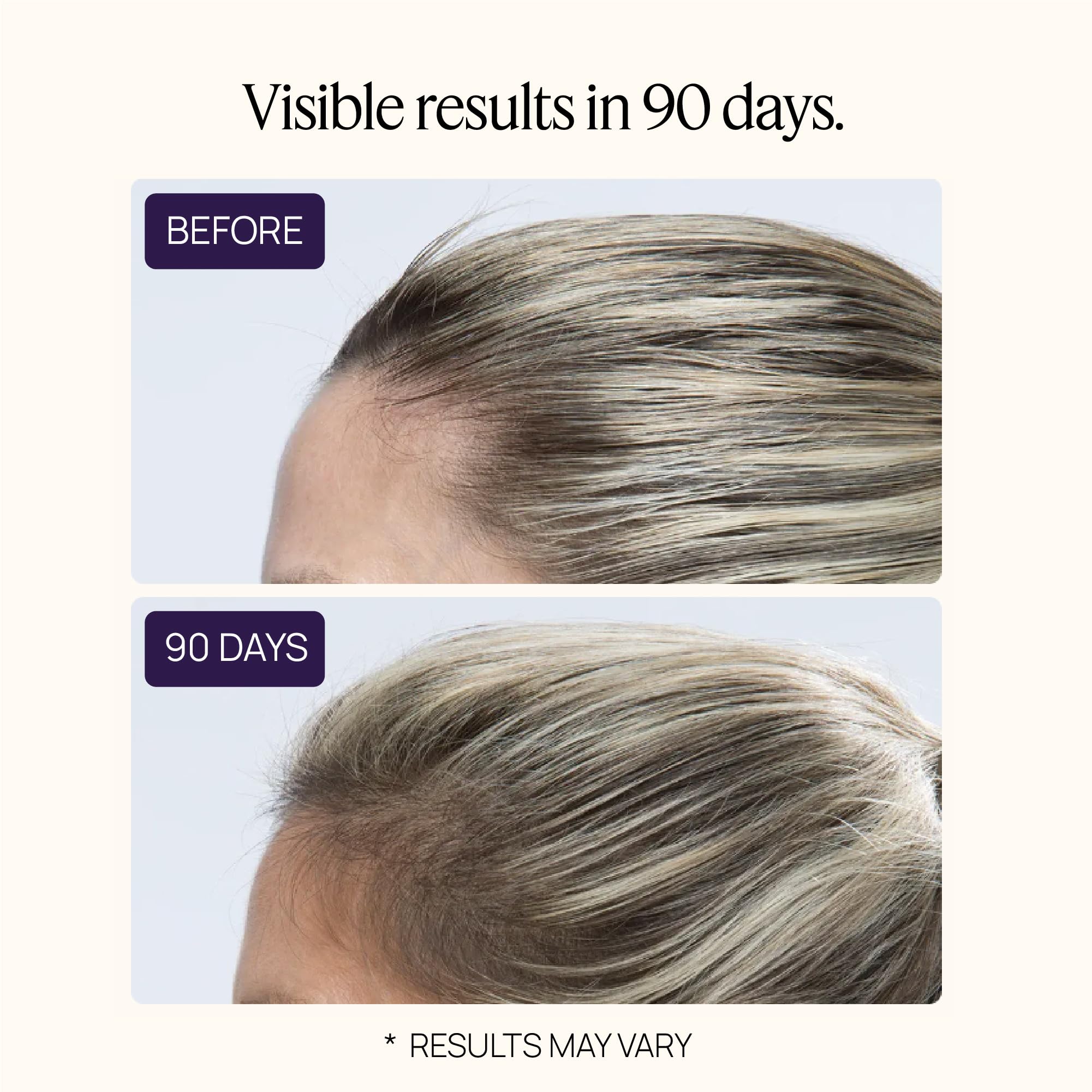 Women's Hair Growth Peptides, Doctor Recommended, Follicle Fortifying Biotechnology, Clinically Shown to Reduce Hair Loss