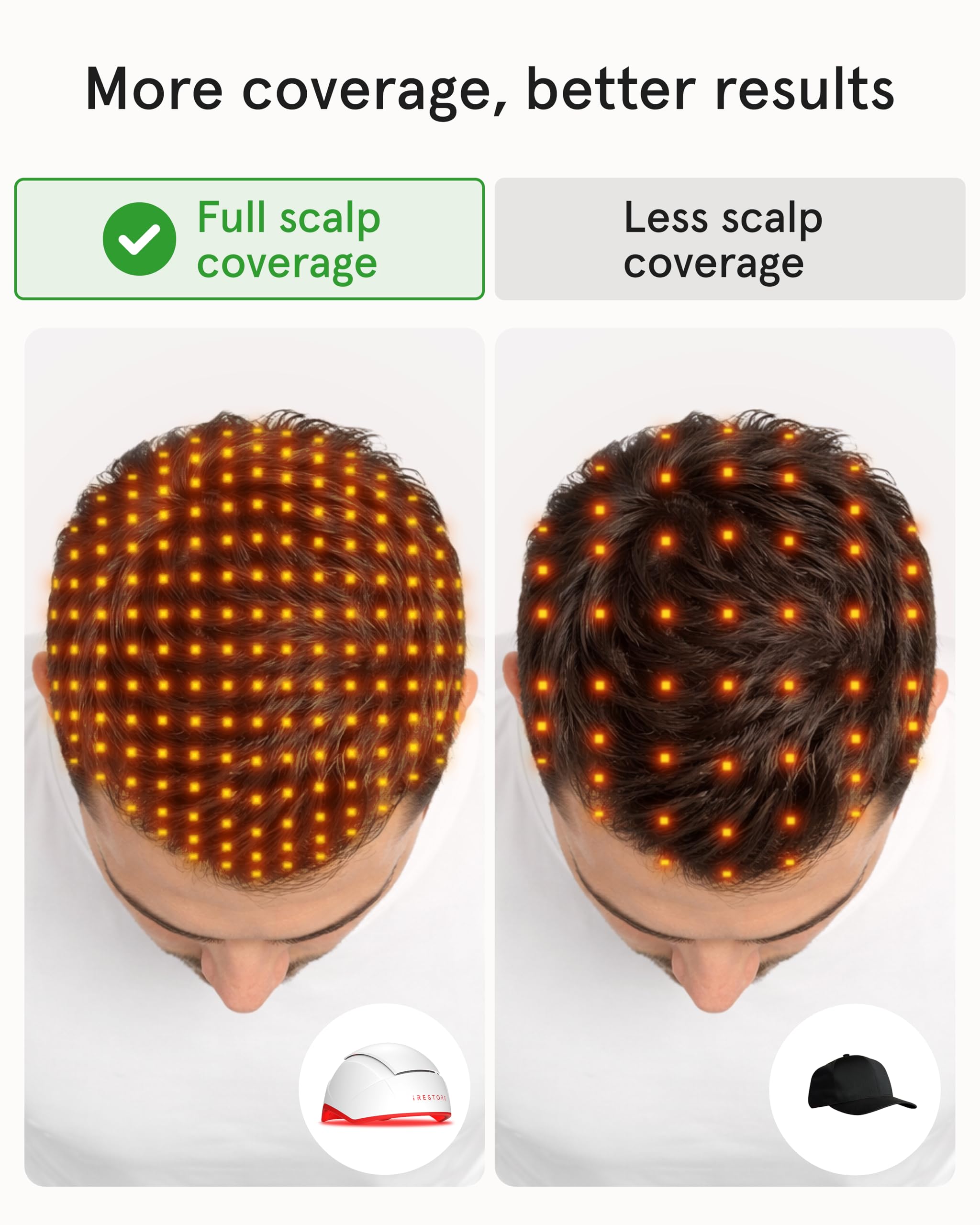 iRestore Professional Laser Red Light Therapy for Hair Growth System - FDA Cleared Hair Loss, Hair Thinning & Alopecia Treatment for Men & Women - 282 Lasers & LEDs