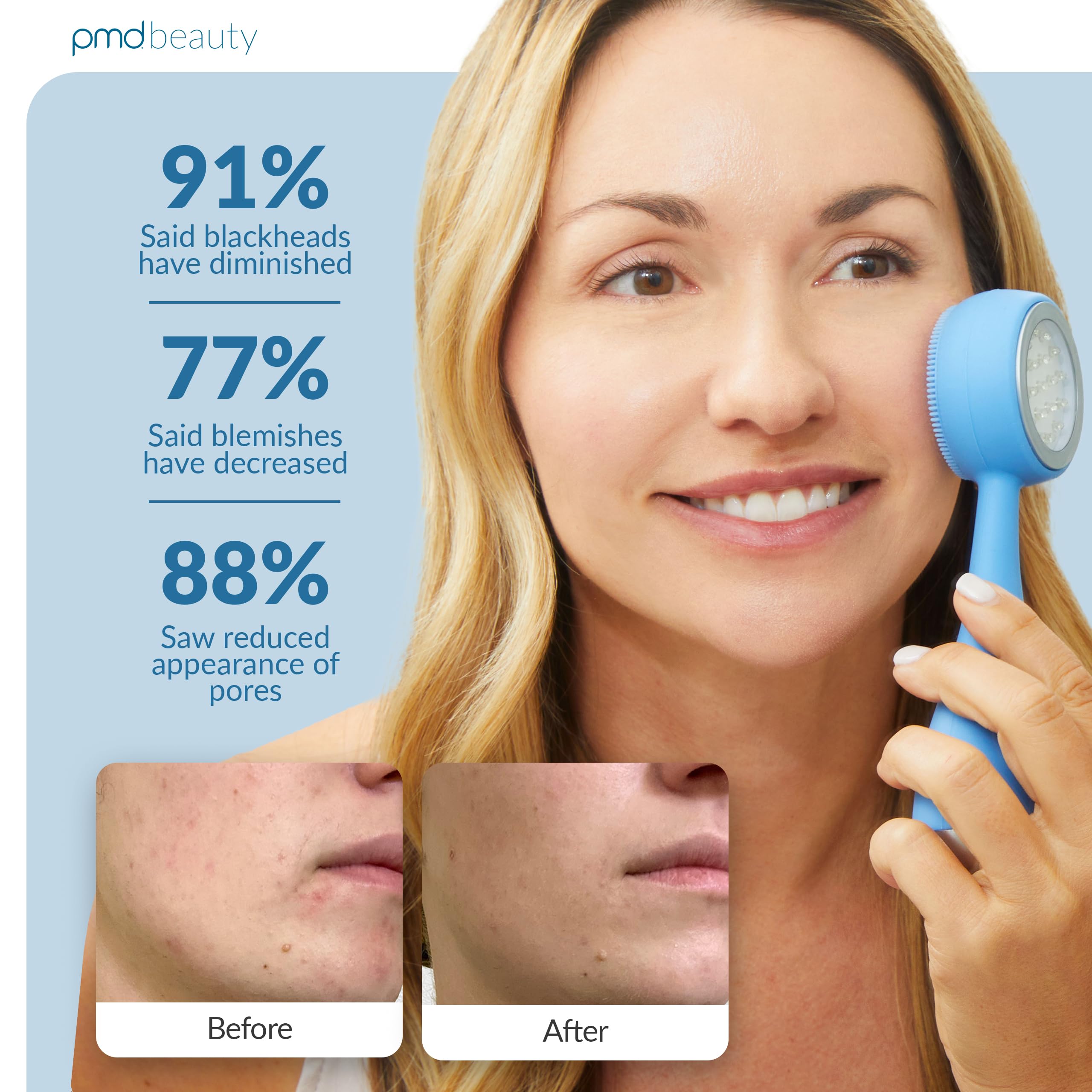 PMD Beauty Clean, Acne, and Redvolution - Electric Facial Cleansing Brush, Smart Facial Device with Silicone Brush & Anti-Aging Massager, Red and Blue LED Light