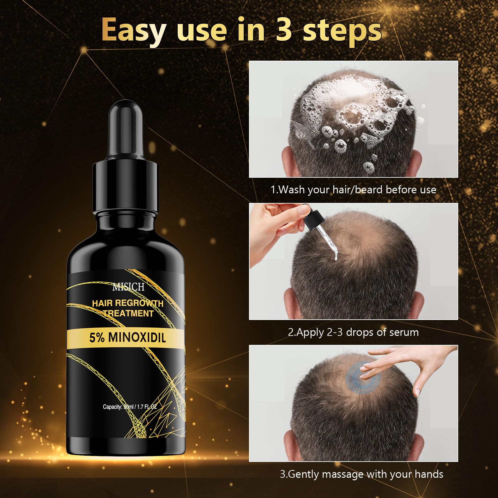 MGLIMZ 5% Minoxidil for Men Women Hair Growth, Hair Growth minoxidil for men beard Regrowth Treatments, Extra Strength Minoxidil Hair Oil for Thicker Longer Fuller Healthier Hair