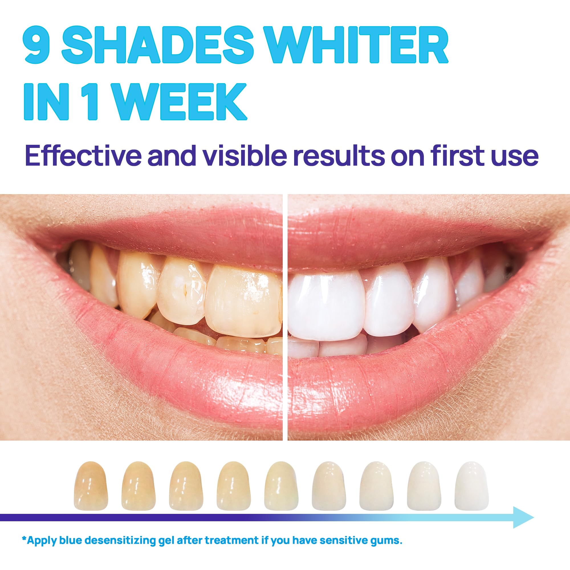 Whitebite Pro Advanced Teeth Whitening Kit | No Sensitivity and Enamel Safe | Effective Tooth Stain Remover | Whiter in 7 Days (Unflavored)