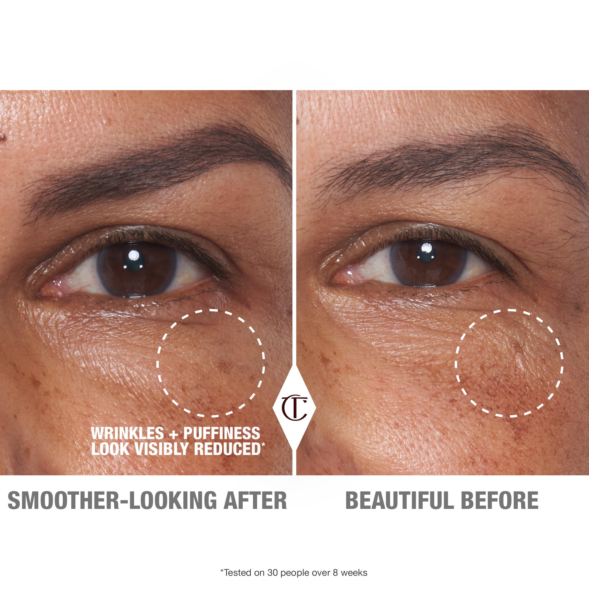 Charlotte Tilbury Cyro-Recovery Eye Serum - Cooling Dark Circles Under Eye Treatment - Addresses Fine Lines, Wrinkles & Puffiness - Infused with Caffeine to Boost Elasticity