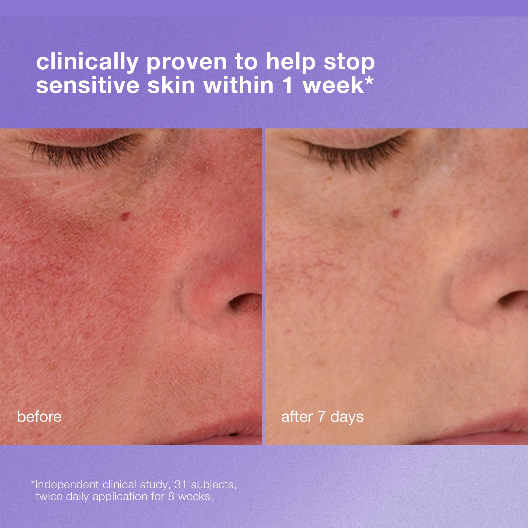 Dermalogica Stabilizing Repair Cream, Face Moisturizer for Sensitive Skin with Cica - Strengthens, Soothes, and Repairs Skin Barrier, 1.7 fl oz