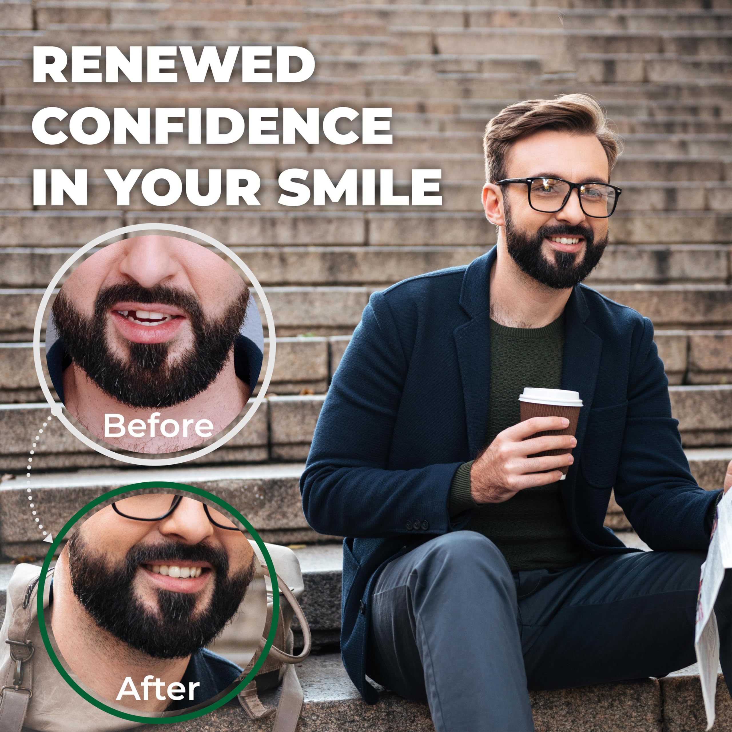 Amazing Temporary Tooth Replacement Kit, Temp Missing Teeth Repair,  Natural Shade