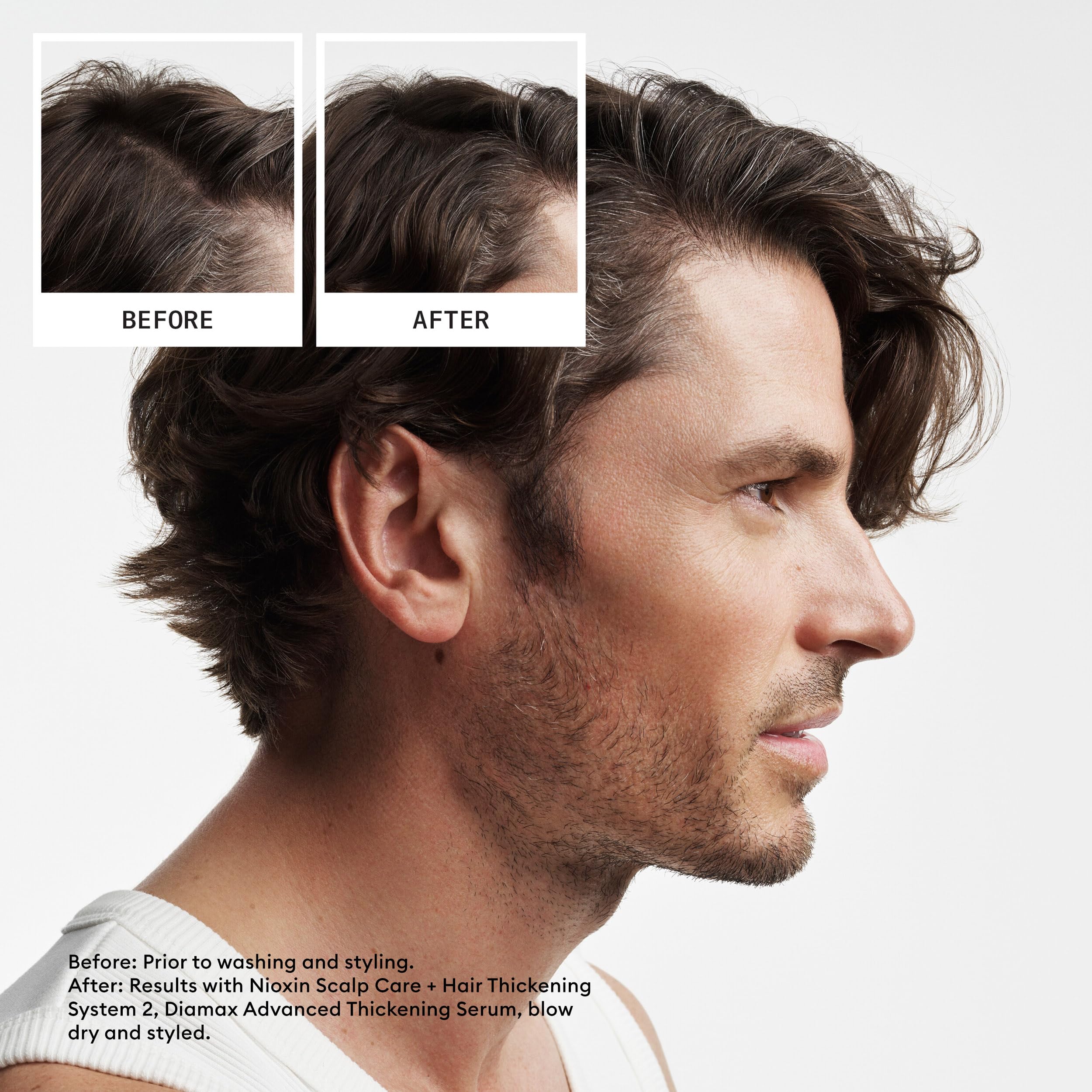 NIOXIN Scalp + Hair Thickening System 2 Shampoo| For Natural or Untreated Hair with Progressed Thinning |With Niacinamide and Biotin |10.1 Fl oz.