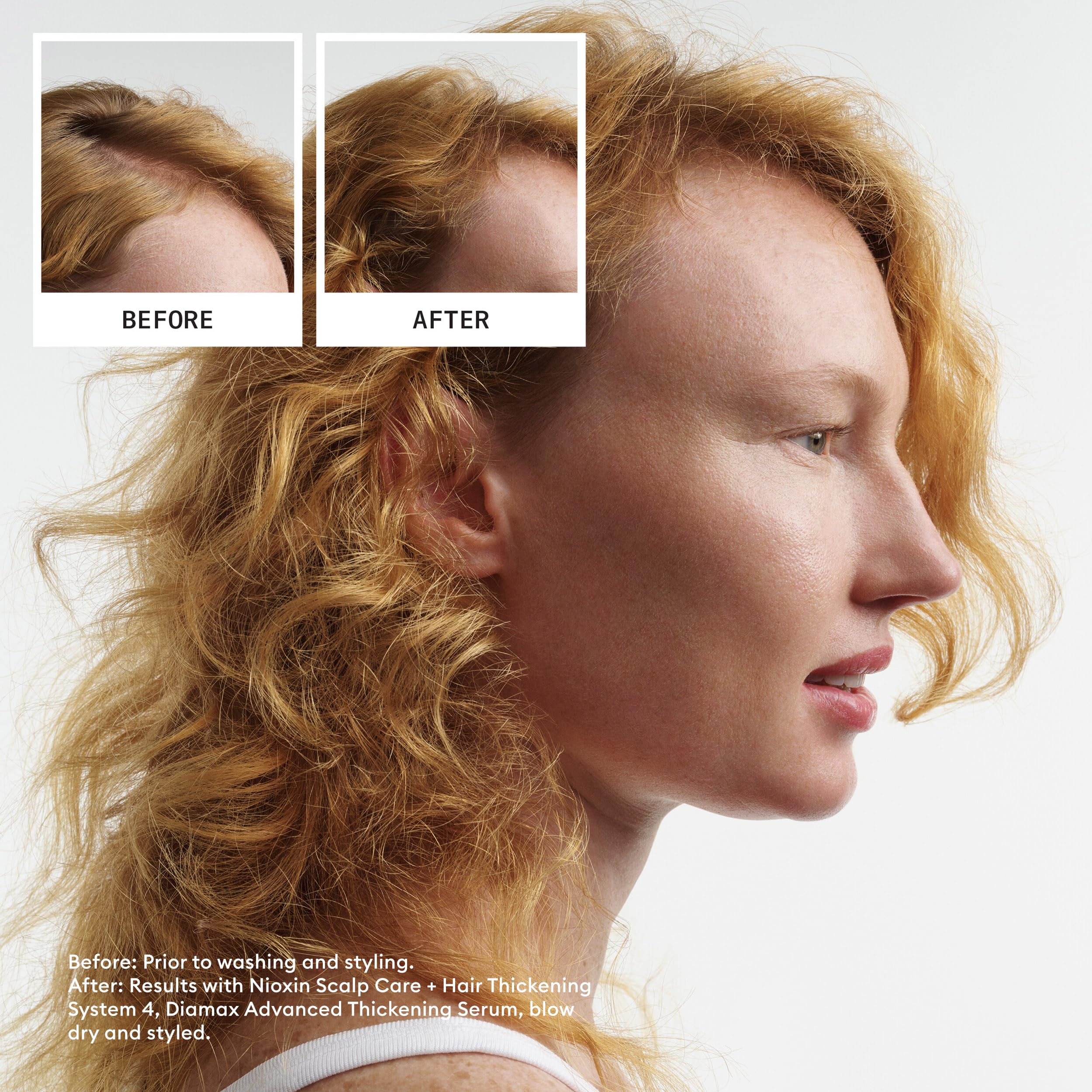 Nioxin System 4 Scalp + Hair Shampoo | For Colored or Damaged Hair with Progressed Thinning | With Niacinamide and Biotin | 10 Fl oz.