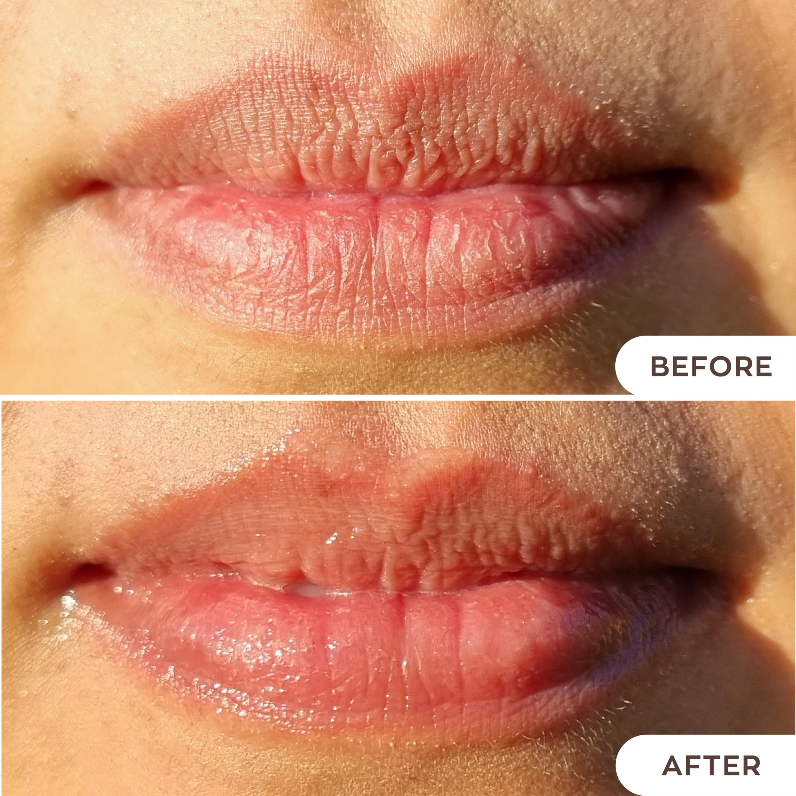 Hanalei Lip Treatment for Dry, Chapped Lips – Intensive Overnight Moisturizer with Kukui Oil, Shea Butter & Grapeseed Oil – Hydrating Balm for Healing Cracks – Clear Tint, Full-Size 15g – Cruelty-Free