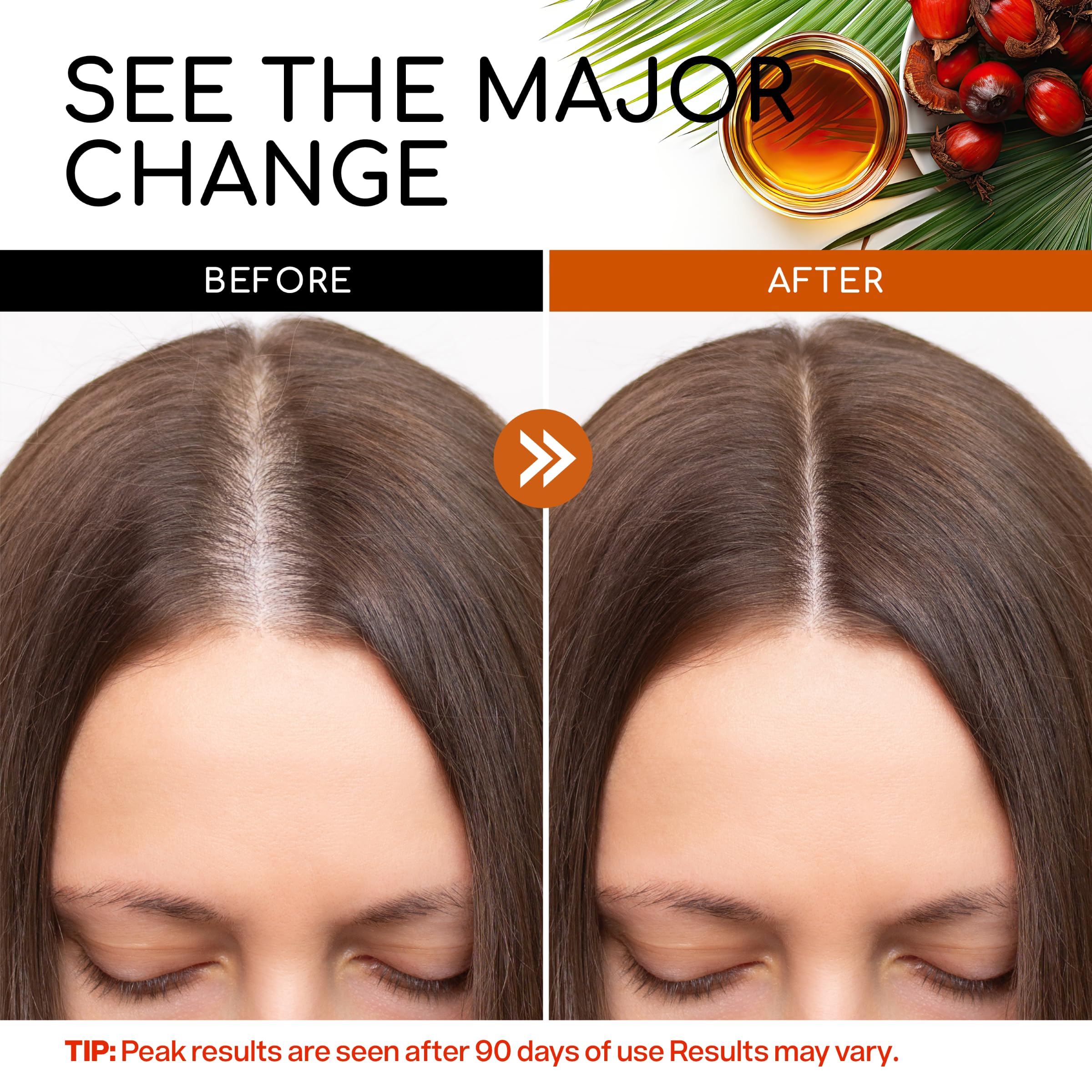 WTSTRIPS Batana Oil for hair growth: 100% raw unrefined pure natural cold pressed Botana oil - Dr Sebi Batana oil from Honduras, Brown