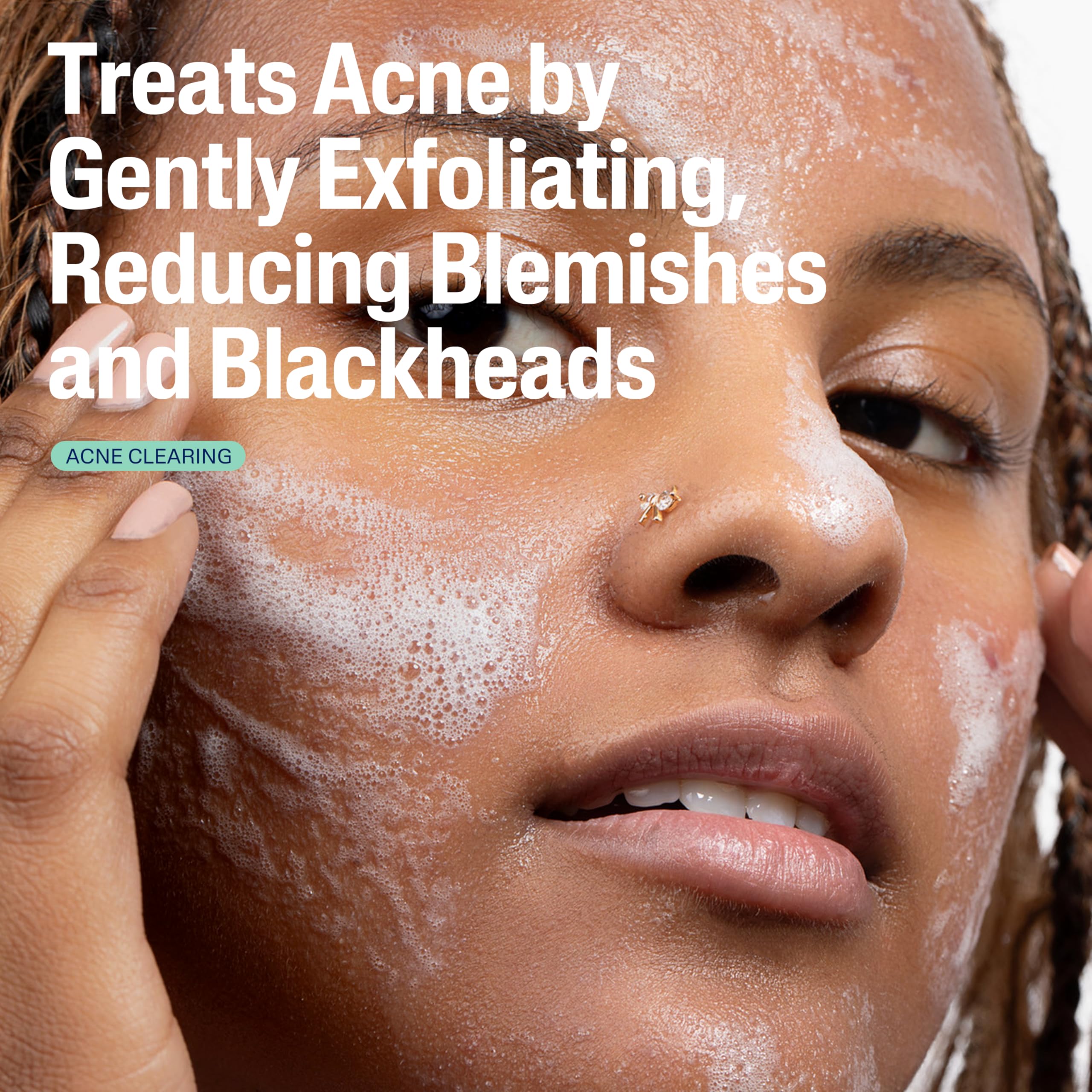 Cetaphil Gentle Clear Pore Clearing Acne Cleanser, Foaming Gel Cleanser for Sensitive, Acne-Prone Skin, 8 Fl Oz Pump Bottle, 2% Salicylic Acid, Gently Exfoliates, Dermatologist Recommended Brand