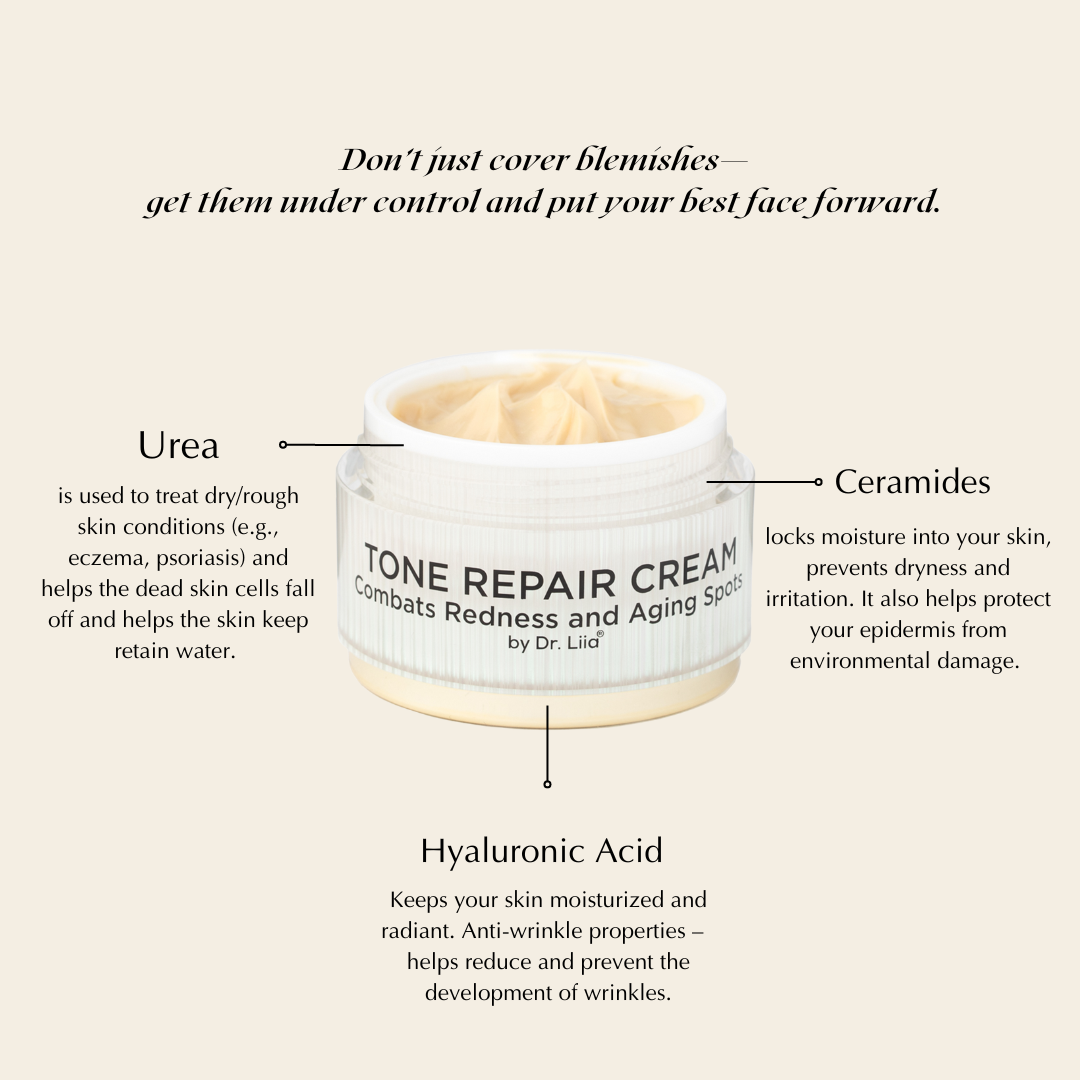 Brightening Face Cream for Redness & Hyperpigmentation