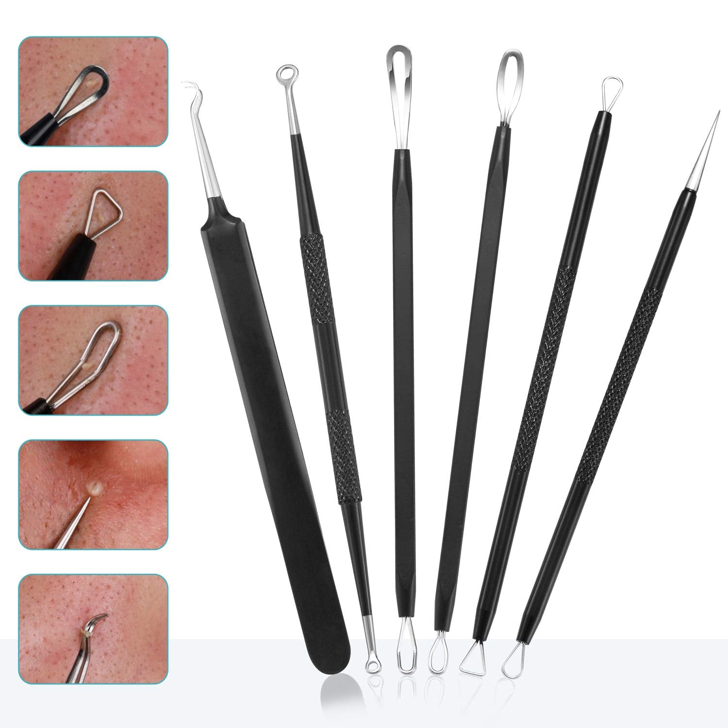 Blackhead Remover Pimple Popper Tool Kit - (6 Piece Kit) - Professional Stainless Pimples Comedone Extractor Removal Tool