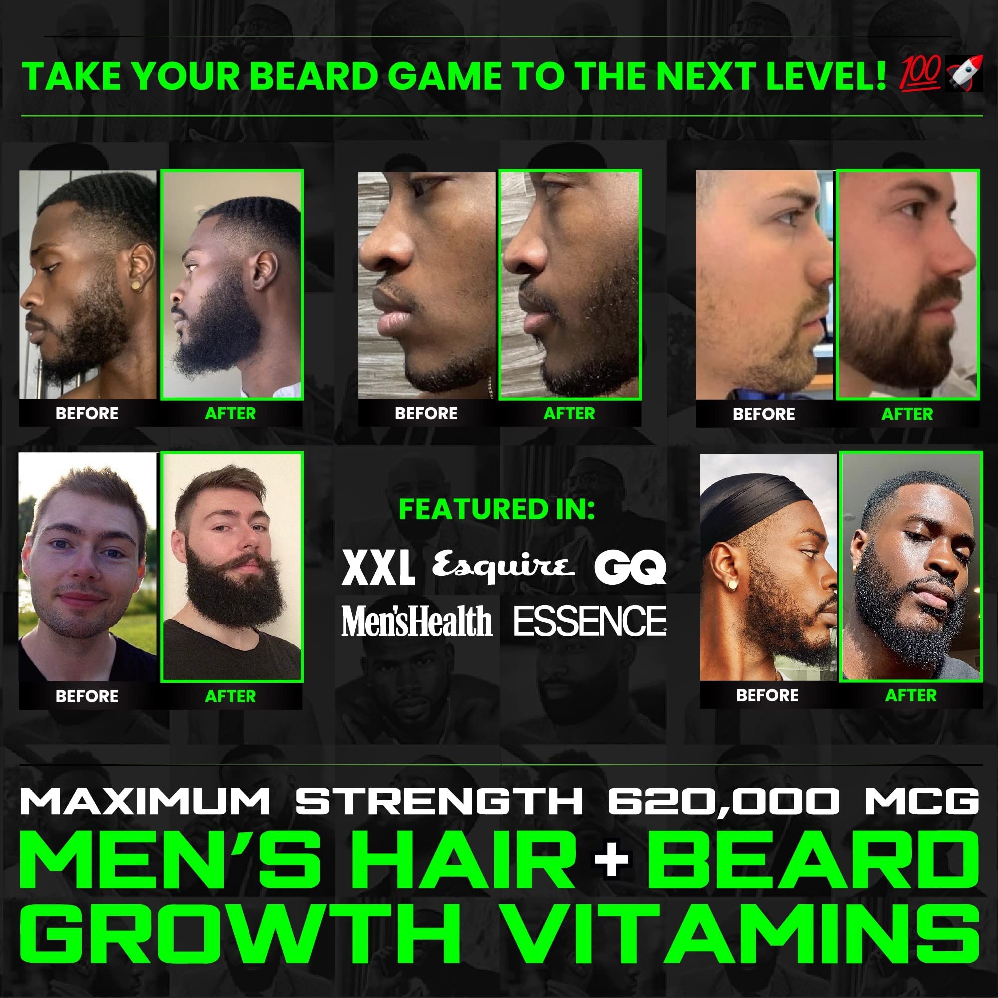 BBS Beard Growth & Hair Growth Vitamins for Men - Maximum Strength 620000mcg Biotin - Collagen - MSM - Keratin - Bamboo Extract - Multivitamin Gummies (Made by Best Beard Stuff USA)