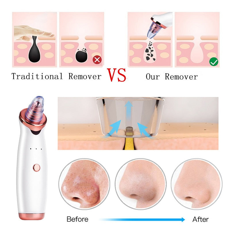 Facial Blackhead Remover Electric Vacuum Machine